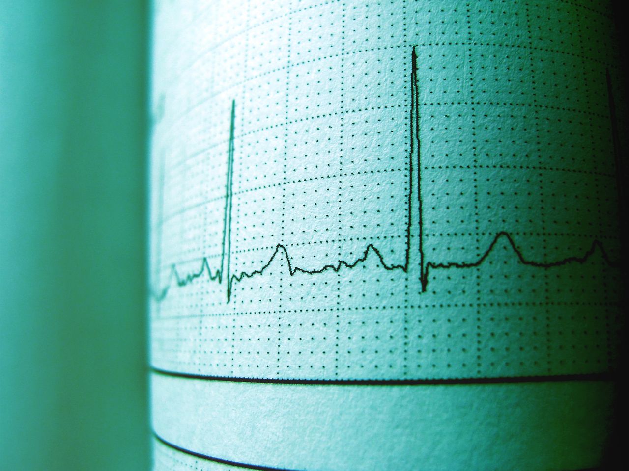 project-01-d Close-up of an ECG printout displaying heartbeat rhythm and frequency for medical analysis.
