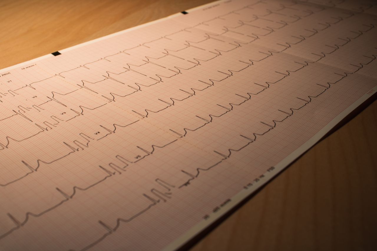 project-02-d Close-up of an ECG printout depicting heart activity, placed on a wooden surface.