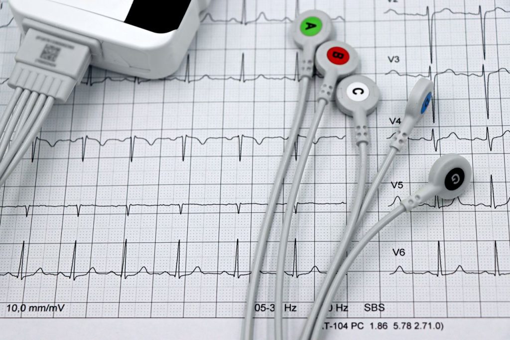 Close-up of ECG monitor leads on a printed cardiogram, showcasing heart health diagnostics.