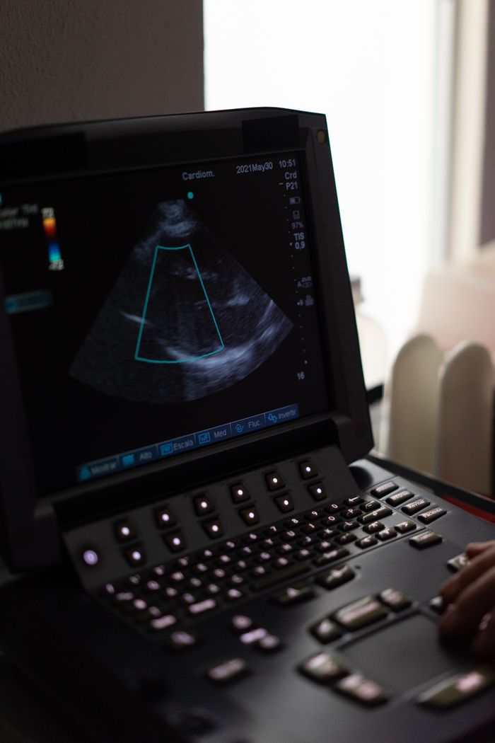 project-02-b Close-up of an ultrasound machine screen showing a cardiogram in a clinical environment.