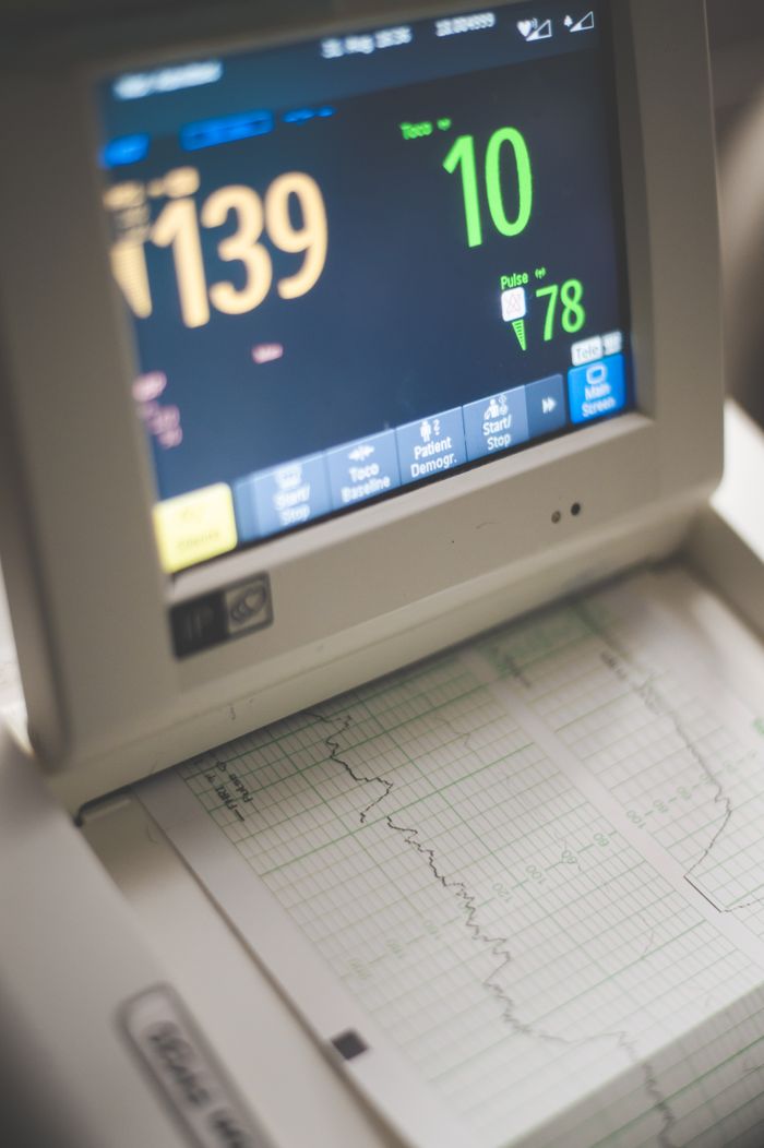 project-02-a Close-up of an ECG monitor displaying heart rate and pulse data in a medical setting.